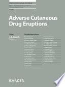 Adverse Cutaneous Drug Eruptions