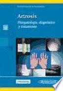 Artrosis, Fisiopatolo ́gía, diagnóstico y tratamiento