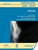 Artrosis