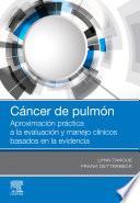 Cáncer de Pulmón