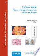 Cáncer renal. Nuevas estrategias terapéuticas medico-quirúrgicas