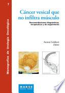Cáncer vesical que no infiltra músculo