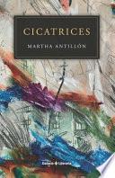 Cicatrices