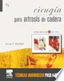 Cirugía para artrosis de cadera + DVD y Website