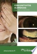 Conjuntivitis alérgicas