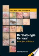 Dermatología General