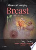 Diagnostic Imaging: Breast E-Book