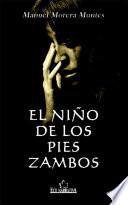 El niño de los pies zambos