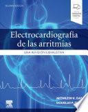 Electrocardiografía de Las Arritmias