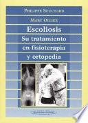 Escoliosis
