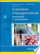 Fracturas Osteoporóticas. Prevención y Tratamiento