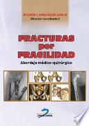 Fracturas por fragilidad