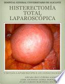 Histerectomía Total Laparoscópica