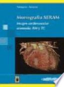 Imagen Cardiovascular Avanzada