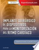 Implante Quirúrgico de Dispositivos Para La Monitorización del Ritmo Cardíaco