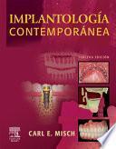 Implantología contemporánea