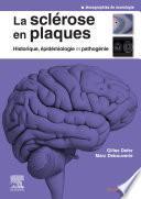 La sclérose en plaques - Historique, épidémiologie et pathogénie