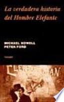 La verdadera historia del Hombre Elefante