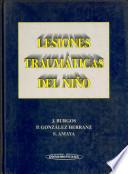 Lesiones traumáticas del niño