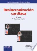 Resincronización cardíaca