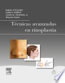 Técnicas avanzadas en rinoplastia