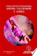 Temas Selectos de Hematolog’a: ANEMIA FALCIFORME Y AFINES