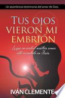 Tus Ojos Vieron Mi Embrión