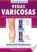 Venas Varicosas - Solución definitiva